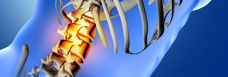 Minimally Invasive Spine Surgery | Mehta Spine