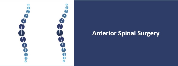 Anterior spinal surgery
