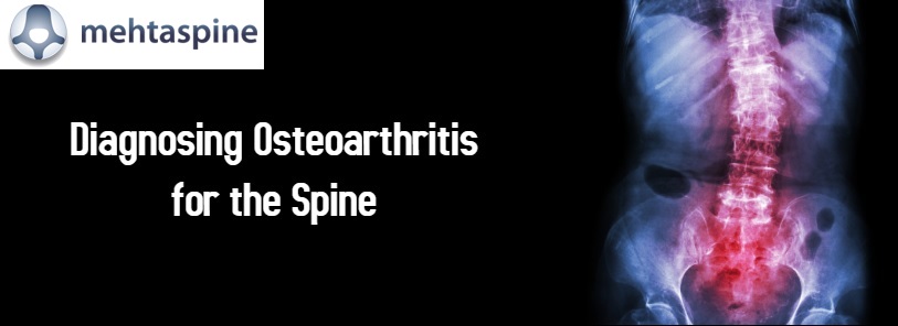 Osteoarthritis for spine