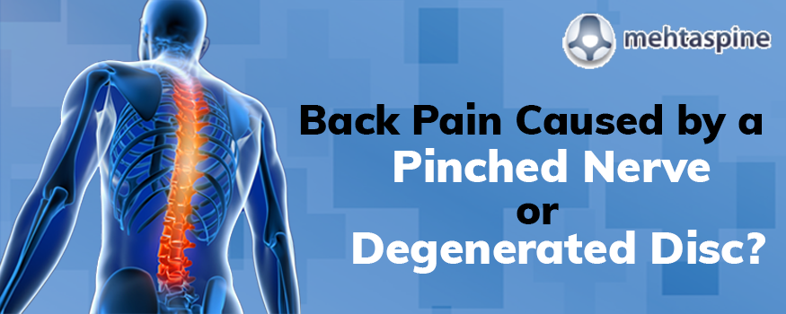 Back Pain Specialist in Bromsgrove