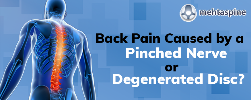 Pinched nerve in neck: Symptoms, causes, treatment, and more