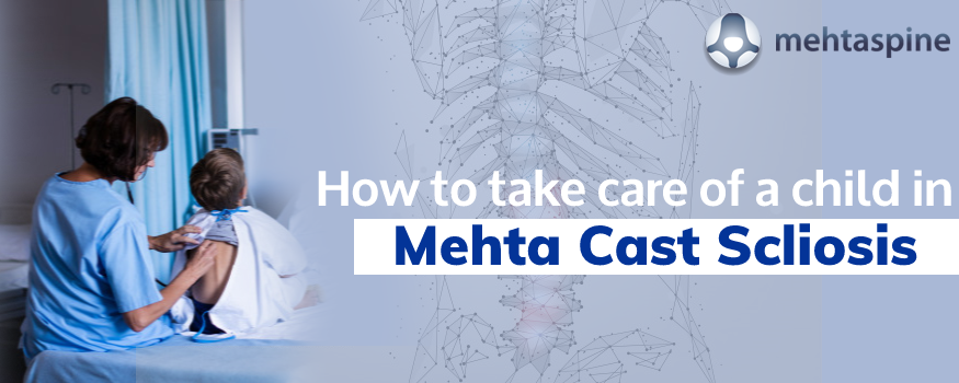 Mehta Cast Scoliosis | Mr Jwalant S Mehta