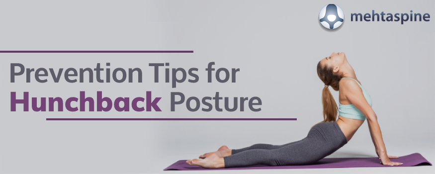 Can bad posture give you a hunchback