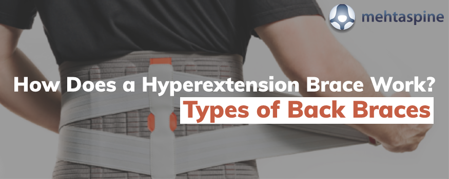 https://www.mehtaspine.co.uk/blog/wp-content/uploads/2021/05/mehta-spinal-How-Does-a-Hyperextension.png