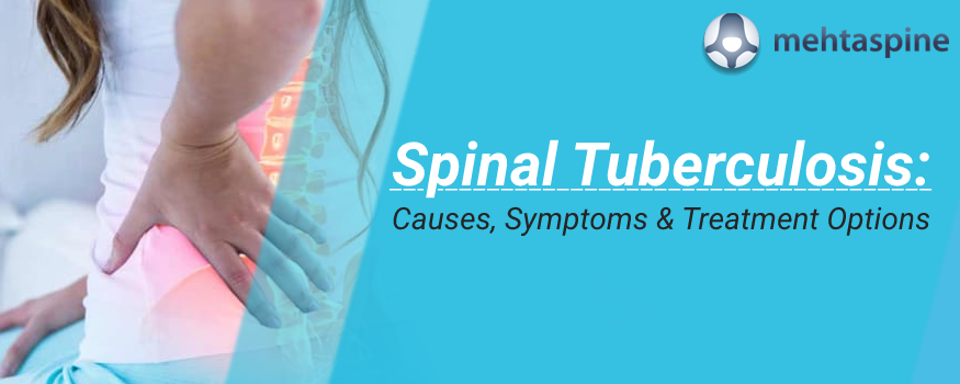 Tuberculosis of the spine