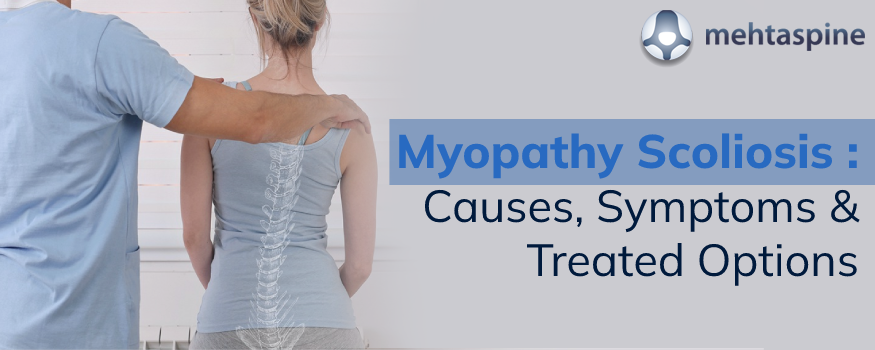General signs and symptoms of myopathy scoliosis