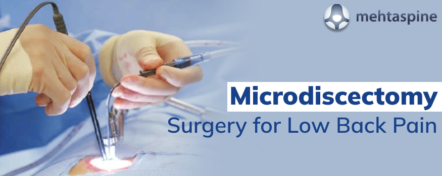 Microdiscectomy Surgery for Low Back Pain | Mehta Spine