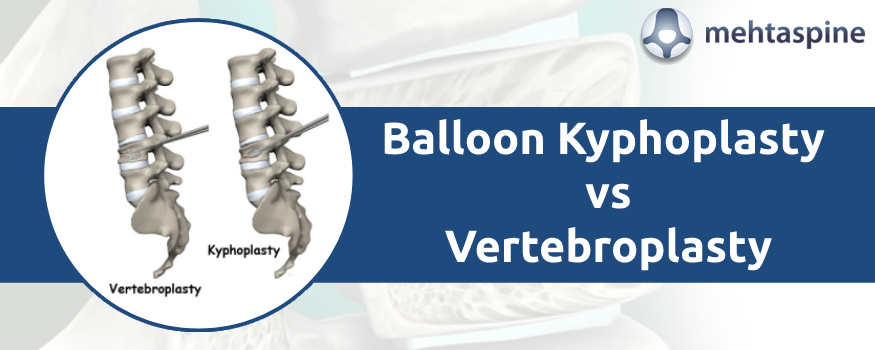 compare balloon kyphoplasty vs vertebroplasty