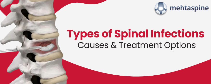 what causes spinal infection