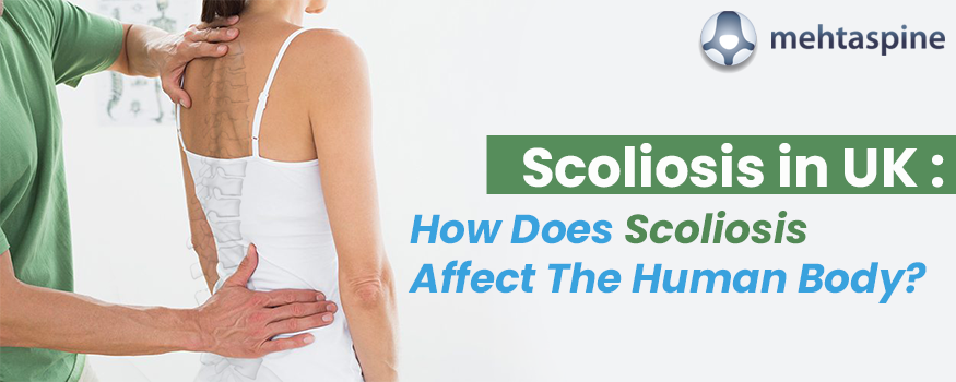scoliosis in uk: how does scoliosis affect the human body?
