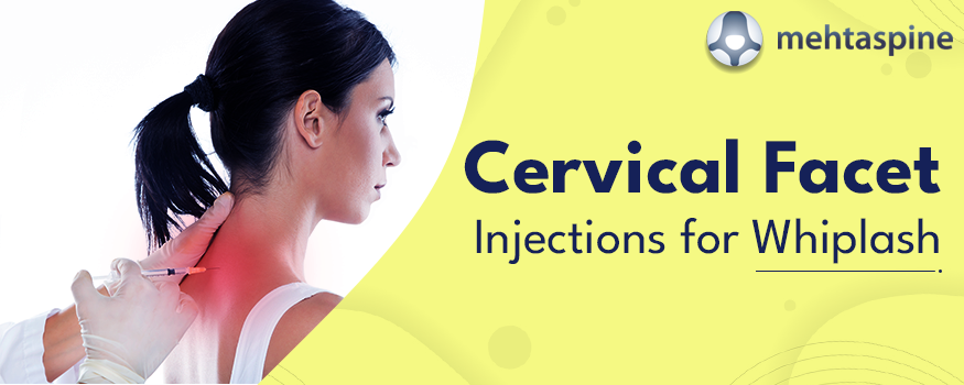 cervical facet injections