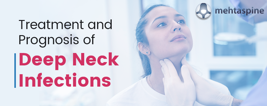 treatment and prognosis of deep neck infections