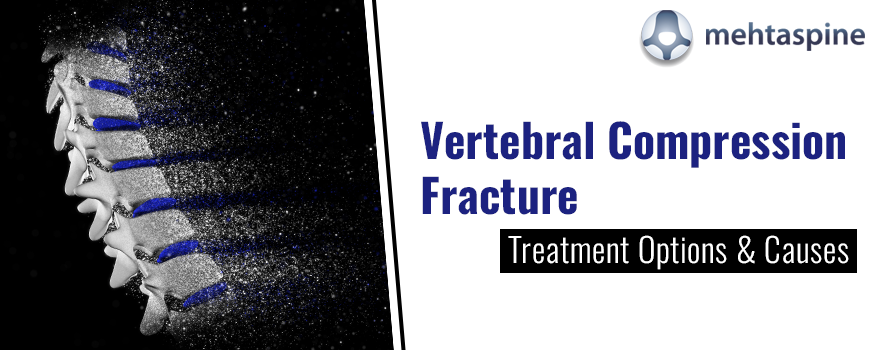 Vertebral Compression Fracture Treatment Options & Causes | Dr.Mehta Spine
