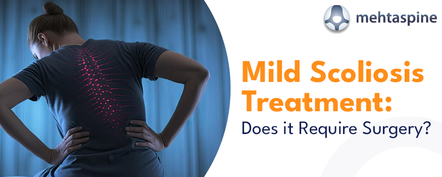 Mild Scoliosis Treatment: Does it Require Surgery?