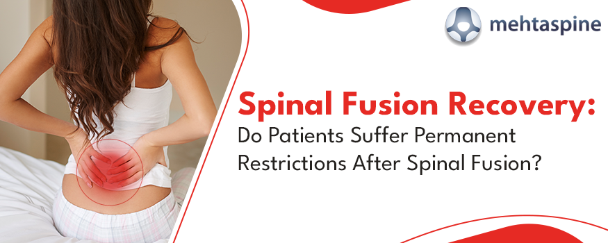 spinal fusion recovery