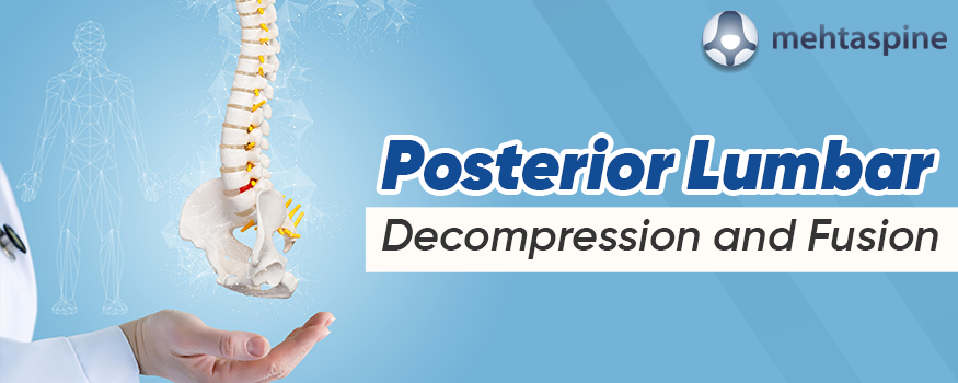 Posterior Lumbar Decompression and Fusion