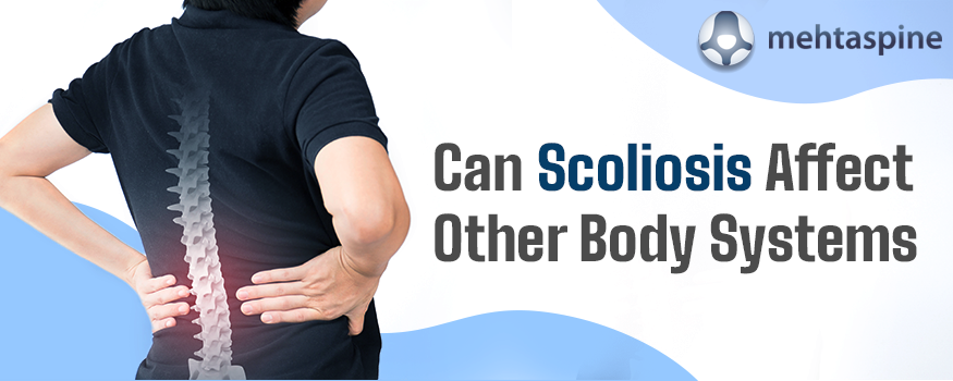 Can Scoliosis Affect Other Body Systems