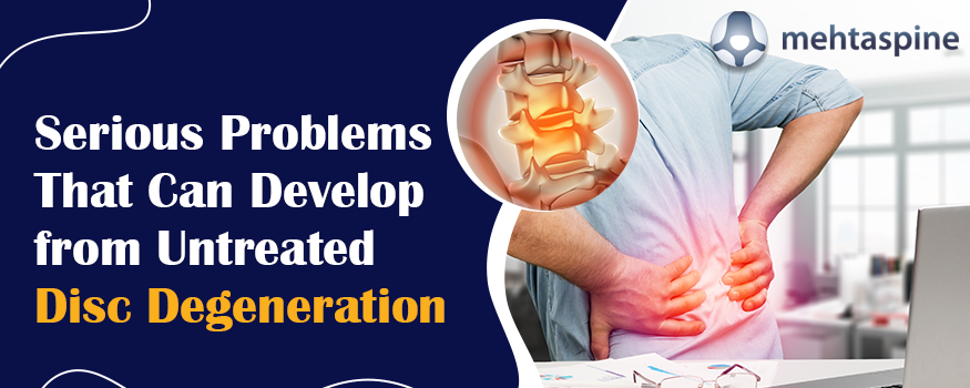 5 Serious Spine Problems That Can Develop from Untreated Disc Degeneration