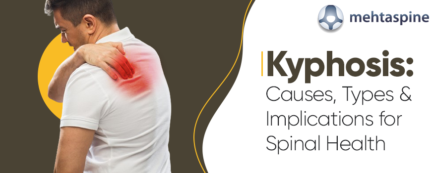 Kyphosis: Causes, Types, and Implications for Spinal Health