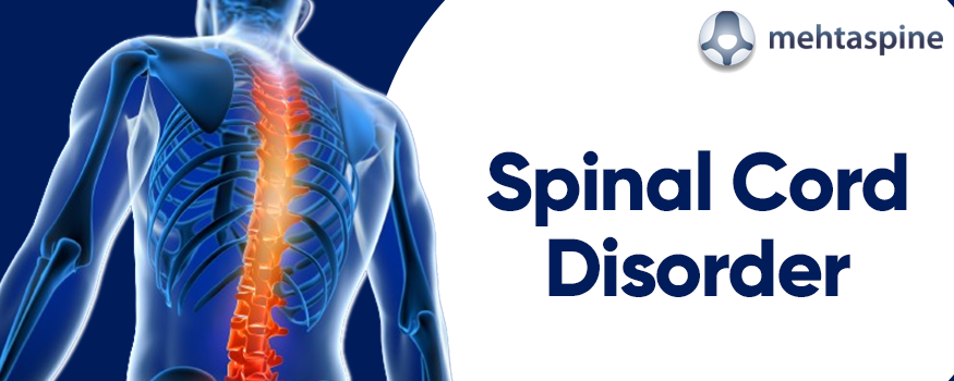 Spinal Cord Disorders: Symptoms, Diagnosis, and Treatment