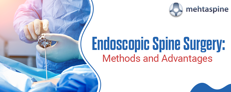Endoscopic-Spine-Surger