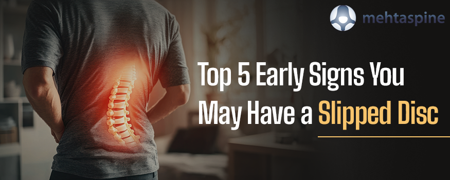Top 5 Early Signs You May Have a Slipped Disc.