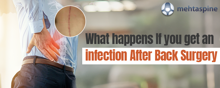 What-happens-If-you-get-an-infection-After-Back-Surgery